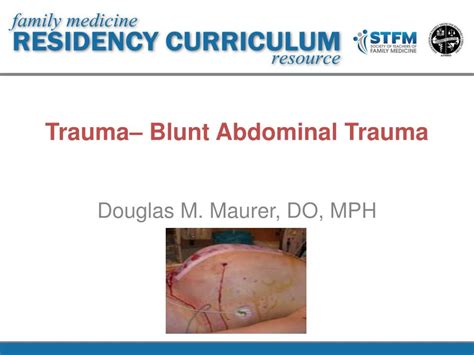 Ppt Trauma Blunt Abdominal Trauma Powerpoint Presentation Free