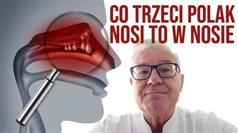 Prof Dariusz Jurkiewicz O Problemach Zwi Zanych Z Leczeniem