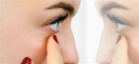 Anisokorie Wann Sie Mit Unterschiedlich Großen Pupillen Zum Arzt