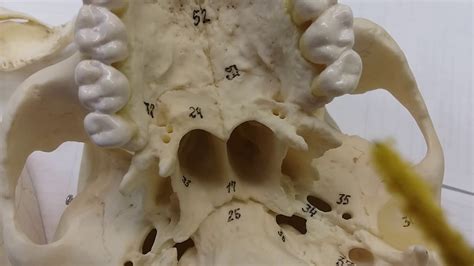 Palatine Bone On Skull
