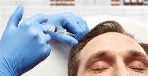 Non Surgical Hair Restoration Understanding The Basics Of Prp Therapy Ageless Living Cold Lake