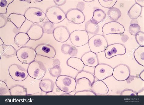 They have a distinct nucleus with all cellular organelles under the microscope, an animal cell shows many different parts called organelles, that work together to keep the cell functional. Animal Cells Under Microscope - Micropedia