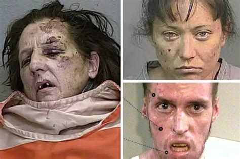 Shocking Before And After Pictures Horrors Of Crystal Meth Drug Abuse