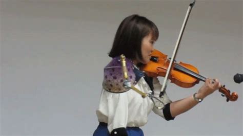 Manami Ito Performs A Violin Solo With A Customized Prosthetic Bow Arm Prosthetics Amputee