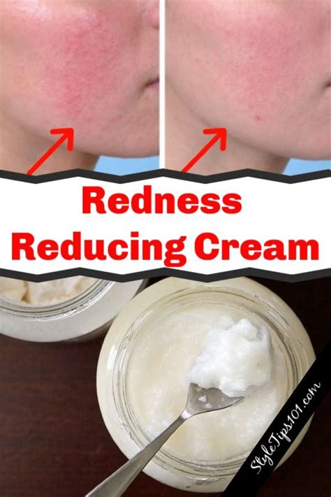 Diy Redness Reducing Cream Redness Reducing Cream Redness Reducer