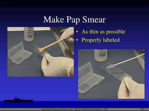 PPT Pap Smear Technique PowerPoint Presentation Free Download ID