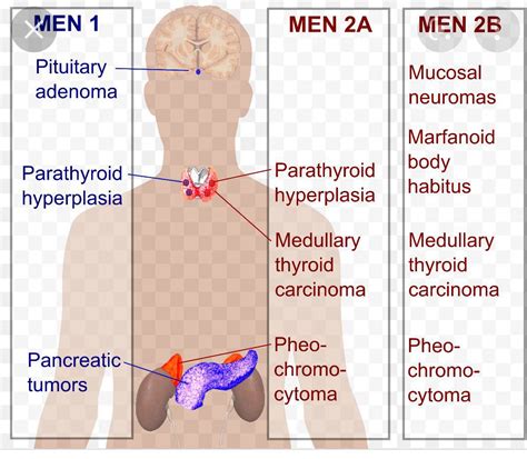 Men Syndromes Medizzy