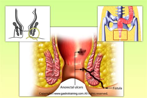 General surgeons are trained to manage a broad spectrum of diseases and injuries to almost any area of the body which requires surgery. Gastroenterology Education and CPD for trainees and ...