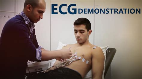 Ecg Lead Placement Osce Exam Demonstration Youtube