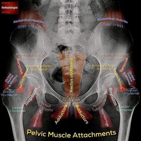 Take A Look At This Annotated X Ray Which Exhibits You The Place A