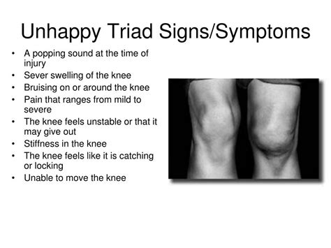 Unhappy Triad Blown Knee Symptoms Causes Treatment