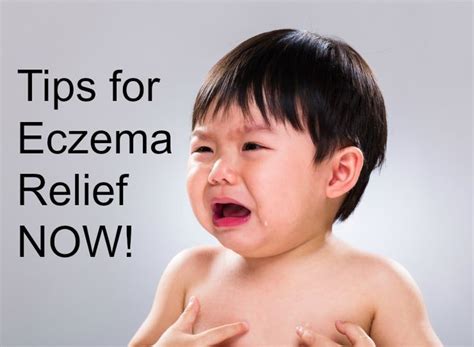 Tips For Eczema Relief Now While Healing From Within Eczema Relief