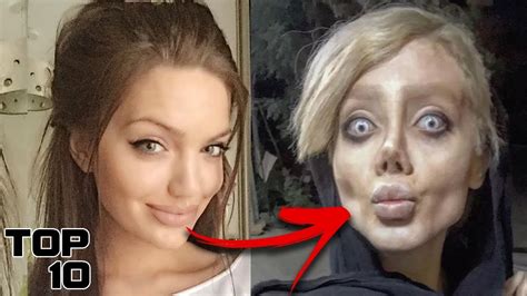 Top 10 Insane Botched Surgeries Youtube