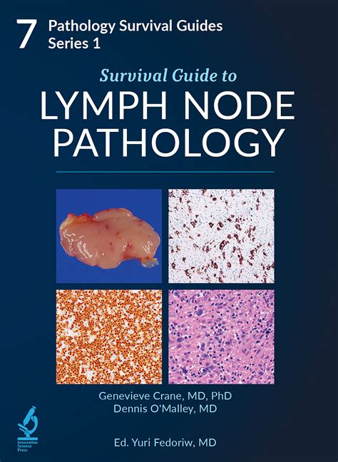 Pathology Survival Guides Series 1 Vol7 Survival Guide To Lymph Node