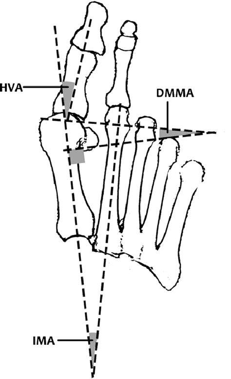 HVA IMA And DMAA Angles Illustrated Download Scientific Diagram