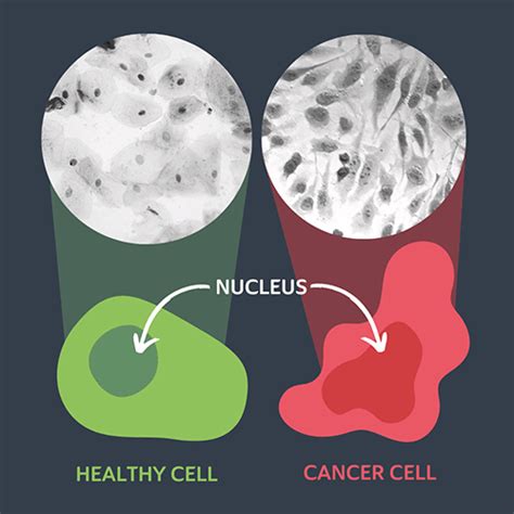 7 Reasons Why Cancer Cells Are Different