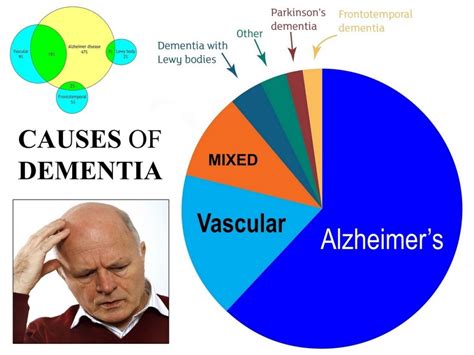 Most Common Form Of Dementia Check More At