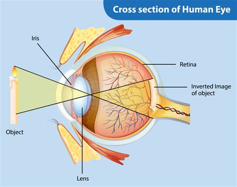 Understanding Retinal Detachment Symptoms Causes Treatment