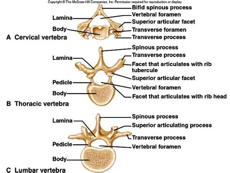 Features Of Typical Vertebrae Cervical Thoracic Lumbar Gonna Print