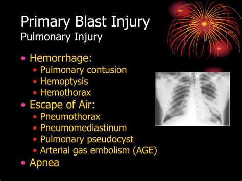 Ppt Evaluation And Treatment Of Blast Injuries Powerpoint