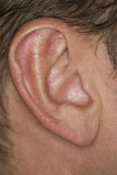 Dry Flaky Ears Livestrongcom