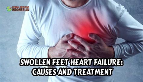Swollen Feet Heart Failure Causes And Treatment Herb Medicine Indonesia