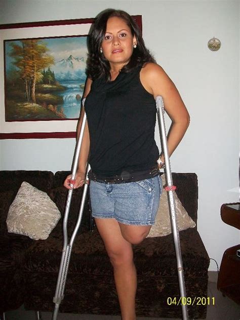 One Leg Amputee Woman Crutches This Month