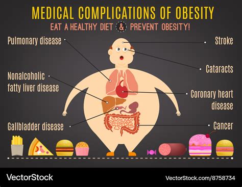 Obesity Infographics 1 09 Royalty Free Vector Image