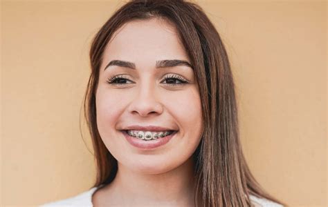 Teenage Girl With Dental Braces Smiling In Chicago Lippitz Orthodontics
