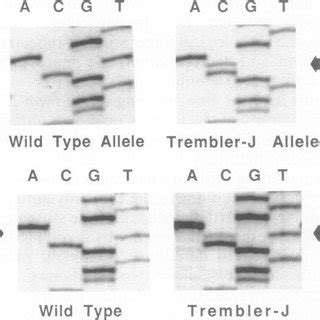 A chromosome contains many genes. (PDF) A Leucine-to-Proline Mutation in the Putative First ...