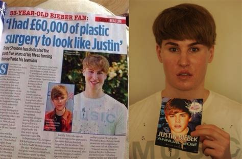 Man Has Surgeries To Look Like Justin Bieber Cyber Gazing