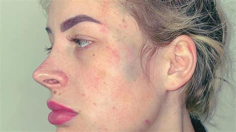 Wir reagieren heute mal auf einen beef zwischen 2 influencerinnen. Krasse Fotos: Aline Bachmann vom Ex blau und grün ...