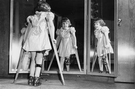 Polio Is Found In The Uk For The First Time In Nearly 40 Years Here