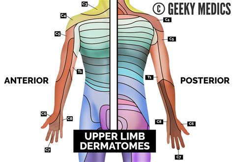 Dermatomes And Myotomes Sensation Anatomy Geeky Medics The Best