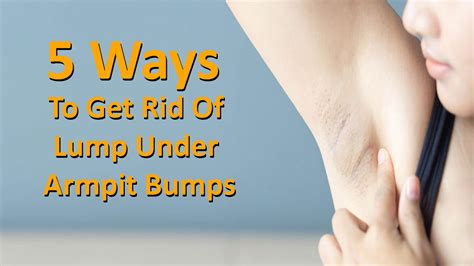 5 Ways To Get Rid Of Lump Under Armpit Bumps Enjoy