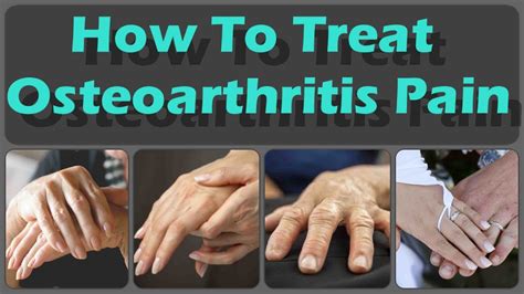 How To Prevent And Treat Osteoarthritis In The Hands And Osteoarthritis Diagnose Youtube