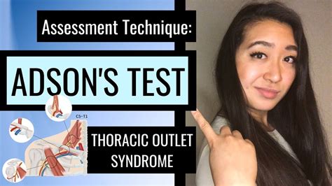 Adsons Test Thoracic Outlet Pt Assessment Youtube