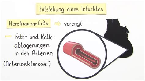 Diese datenbank enthält gesundheitliche und biomedizinische informationen von rund einer halben million freiwilliger aus dem vereinigten königreich. Blut - Herz-Kreislauf-System online lernen
