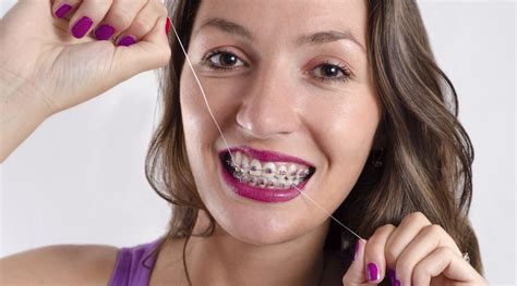 How To Have Good Oral Hygiene With Braces Ismile Orthodontics