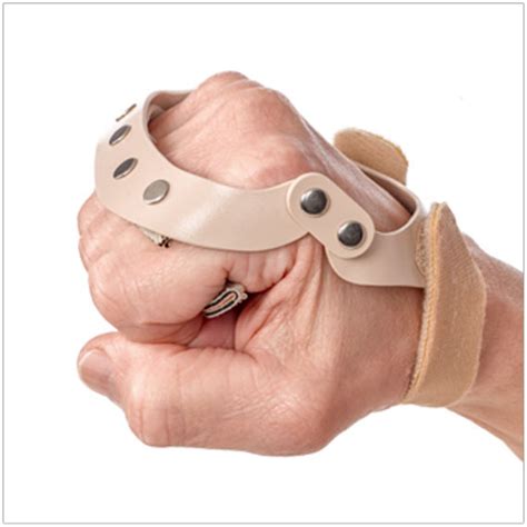 Polycentric Hinged Ulnar Deviation Splint