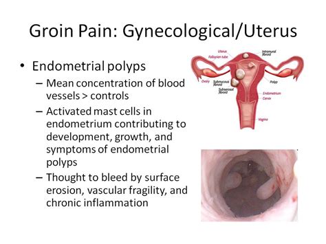 Pain In Hips Thyroid Digestive Problems Onions Youtube Pains In Groin