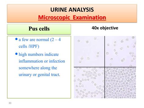 Wbc Pus Cells In Urine Normal Range