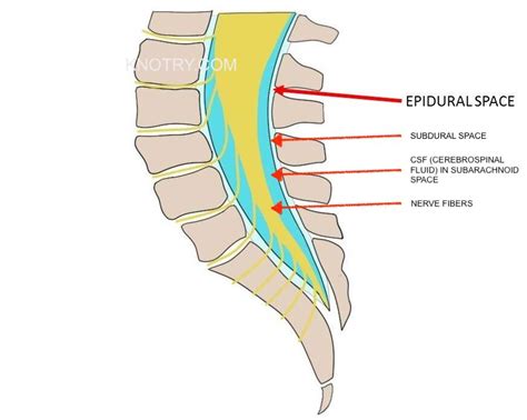 Epidural Steroid Injections — Knotry