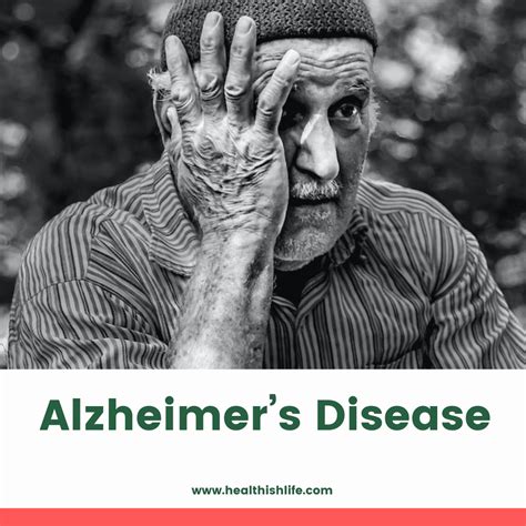 What Is Alzheimers Disease Symptoms Causes And Treatment Healthishlife