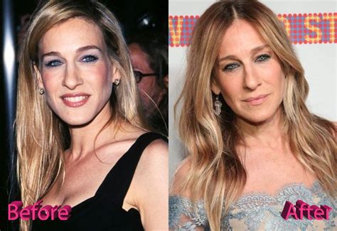 Sarah Jessica Parker Before And After Surgery Procedure Beauty Works Hair Extensions Beauty