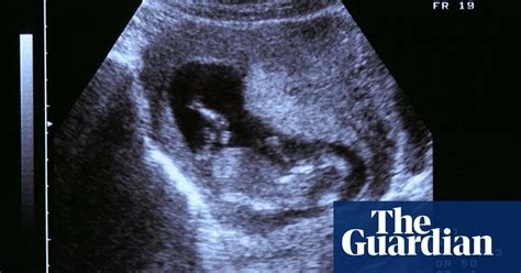 Lets Talk About Miscarriage Life And Style The Guardian