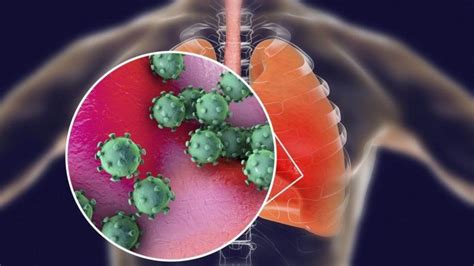 Coronavirus Qué Le Hace Esta Enfermedad Al Cuerpo Y Qué Pasó Con Los