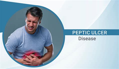 Peptic Ulcer Disease Overview And How Is It Treated