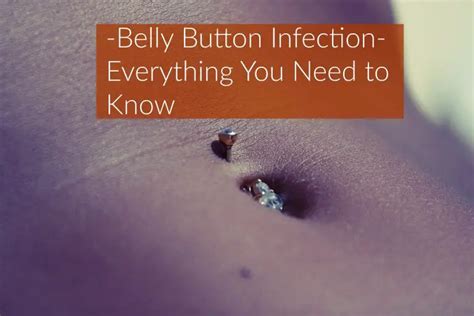 Belly Button Infection Causes Symptoms Treatment