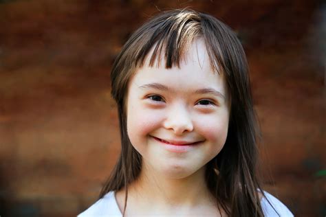 Down syndrome or down's syndrome, also known as trisomy 21, is a genetic disorder caused by the presence of all or part of a third copy of chromosome 21. Down syndrome: 8 facts to know